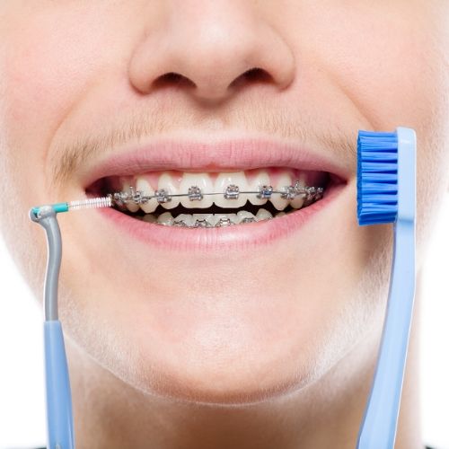 higiene con ortodoncia