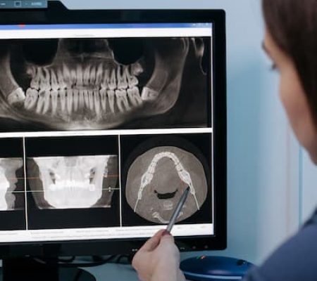 tipos de prótesis dental